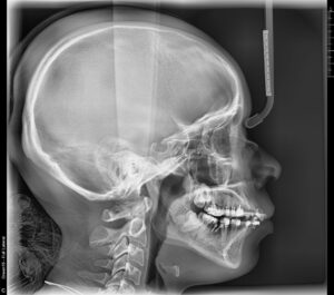 Green 2 - Panoramique 3D VATECH – Image 5