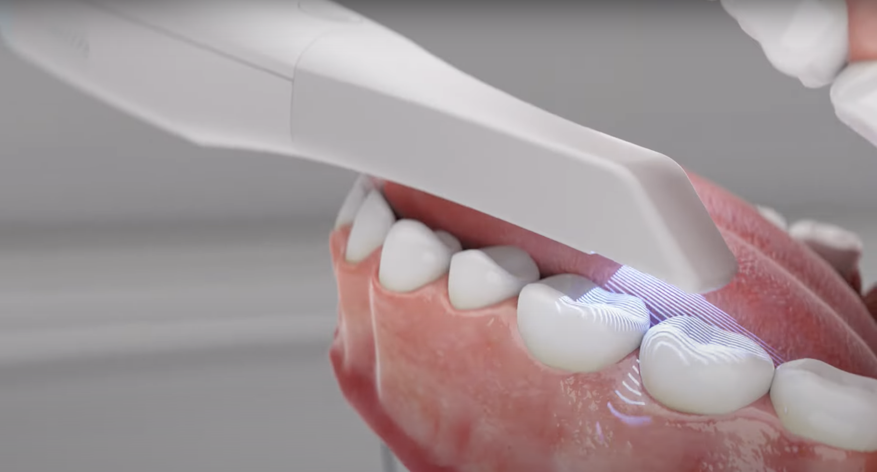 Rayios Scanner Intraoral 3D 