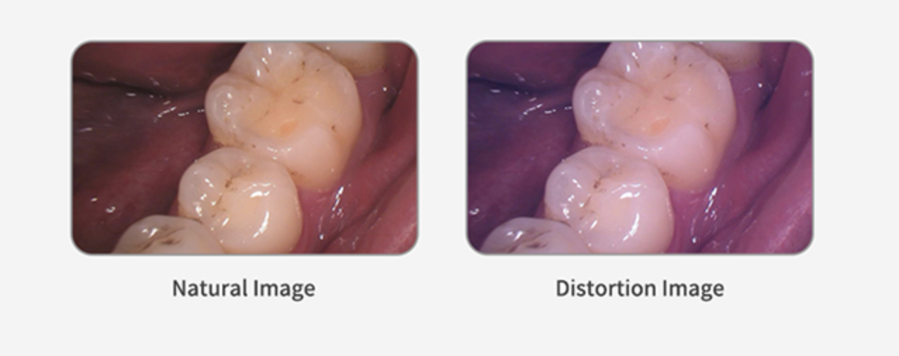 Camera intraorale Ione Dental