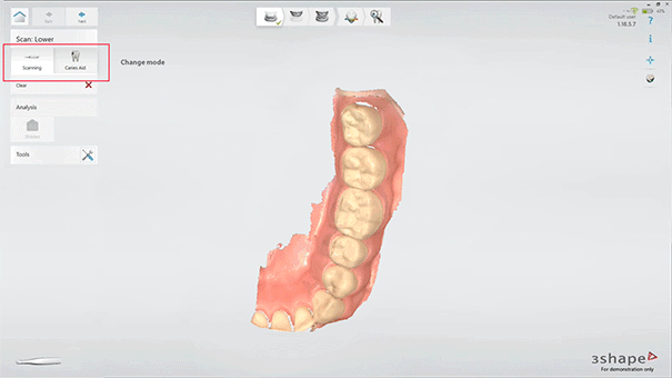 TRIOS 4 WIRELESS - Scanner intraoral 3D
