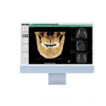 Ez3D-i – Logiciel 3D VATECH Logiciel