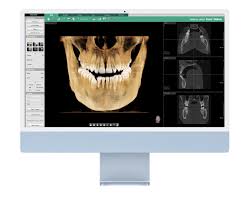 Ez3D-i – Logiciel 3D VATECH