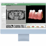 EzDent-i – Logiciel VATECH