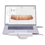 Scanner intraoral 3D Medit i900 - Synergy Dental