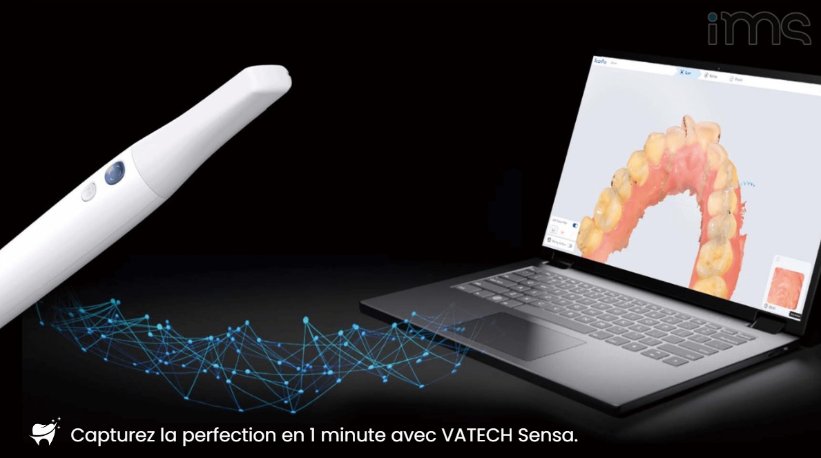 vatech sensa scanner intraoral 3D