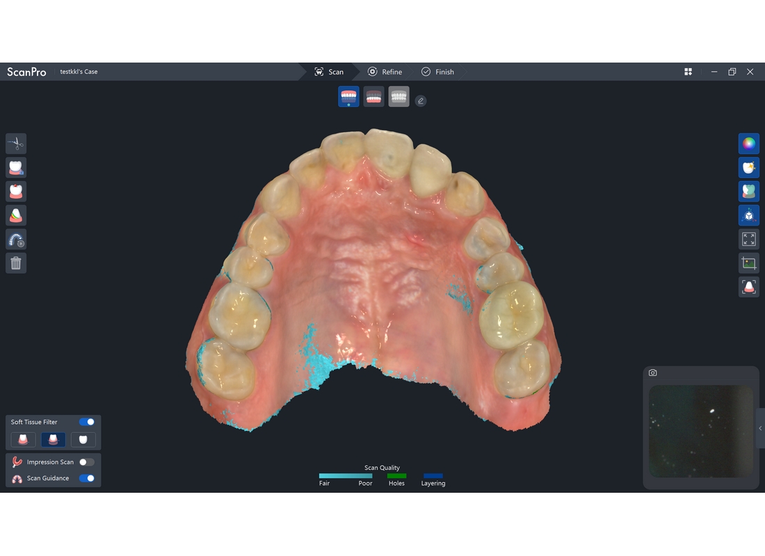 vatech sensa scanner intraoral 3D