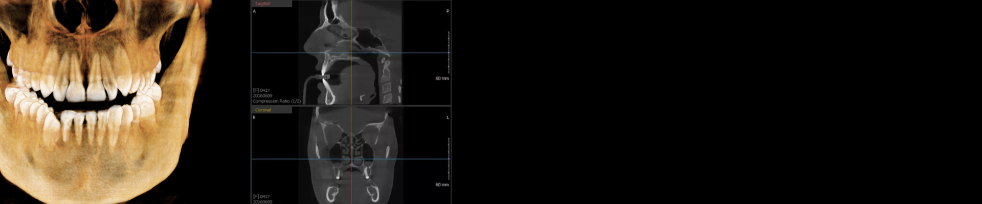 radiologie numerique dentaire